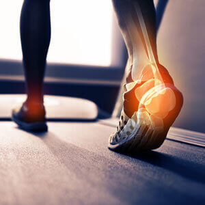 West Perth Osteopathy Heel pain